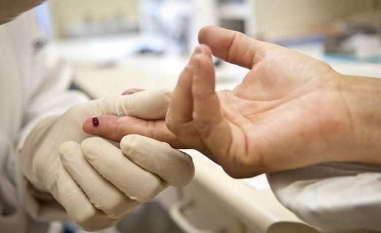 Teste Sifilis e HIV © Agência Brasil