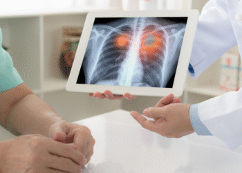 diagnósticos em estágios iniciais têm taxa de sobrevida de 80% a 90% em cinco anos, contra menos de 10% no estágio iv imagem ilustrativa freepik.