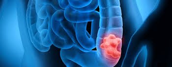 whatsapp image 2026 03 03 at 11.09.21