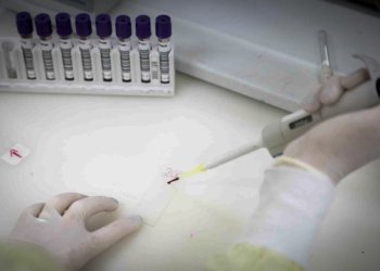 Internado com suspeita de ebola em São Paulo testa positivo para meningite
