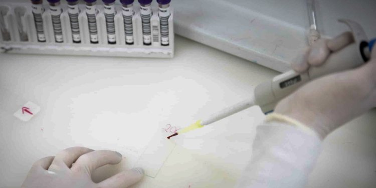 Internado com suspeita de ebola em São Paulo testa positivo para meningite