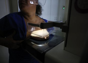 ANS propõe fim da restrição de idade para mamografia digital em planos de saúde