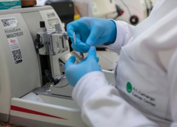 Leucemia mieloide aguda ganha terapia no SUS que evita quimioterapia agressiva