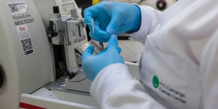 Leucemia mieloide aguda ganha terapia no SUS que evita quimioterapia agressiva