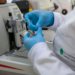 Leucemia mieloide aguda ganha terapia no SUS que evita quimioterapia agressiva