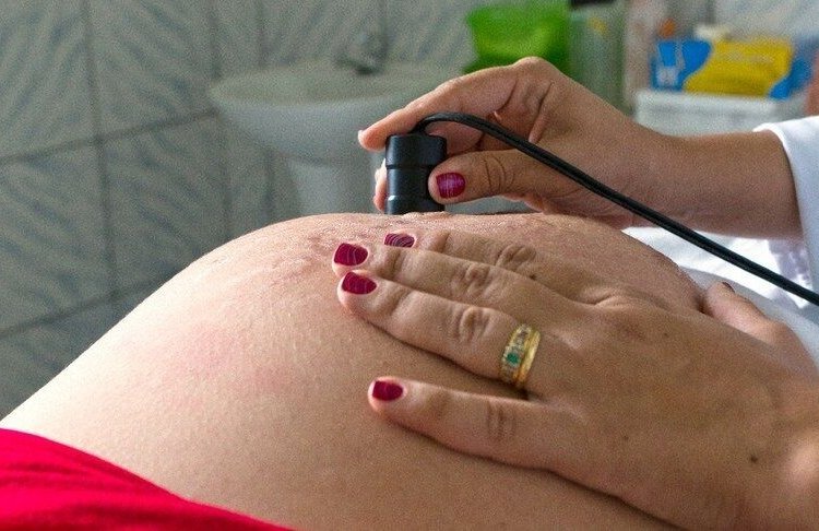 Programa Bolsa Família reduz em 31% o risco de mortalidade materna no Brasil segundo a Fiocruz