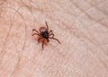 Detailed macro shot of a castor bean tick crawling on human skin, highlighting the insect's small size and potential danger.