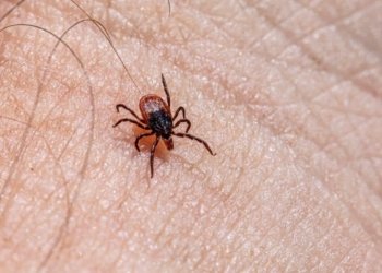 Detailed macro shot of a castor bean tick crawling on human skin, highlighting the insect's small size and potential danger.