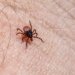 Detailed macro shot of a castor bean tick crawling on human skin, highlighting the insect's small size and potential danger.