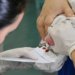 Atraso na triagem neonatal pelo SUS impede diagnóstico precoce de pacientes com AME