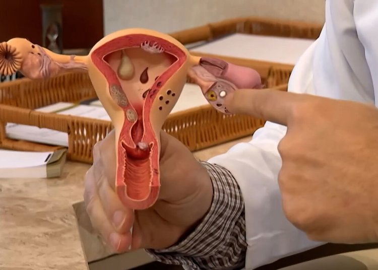 CNPq lança edital de R$ 60 milhões para projetos voltados à endometriose e saúde menstrual