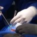 surgeons performing spinal surgery in operating room