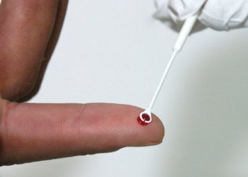 Fiji decreta estado de emergência nacional diante do avanço acelerado dos casos de HIV