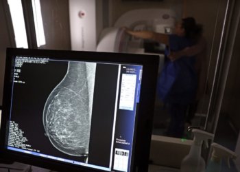 Planos de saúde passam a cobrir mamografia digital para todas as idades a partir de outubro